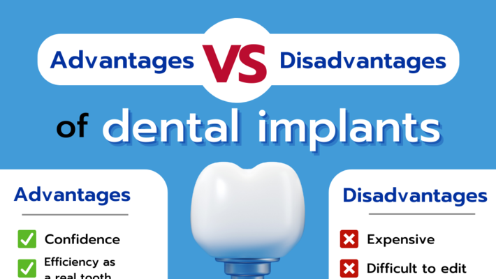 Advantages And Disadvantages Of Dental Implants Chiangmai Hospital