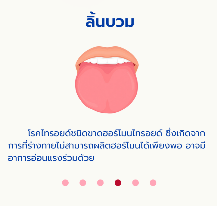 ลิ้นน3.png