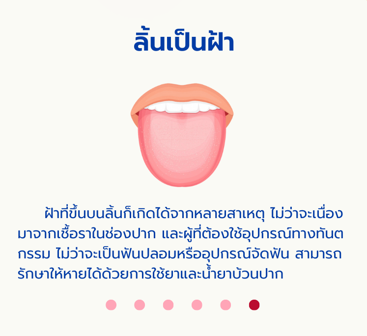 ลิ้นน5.png