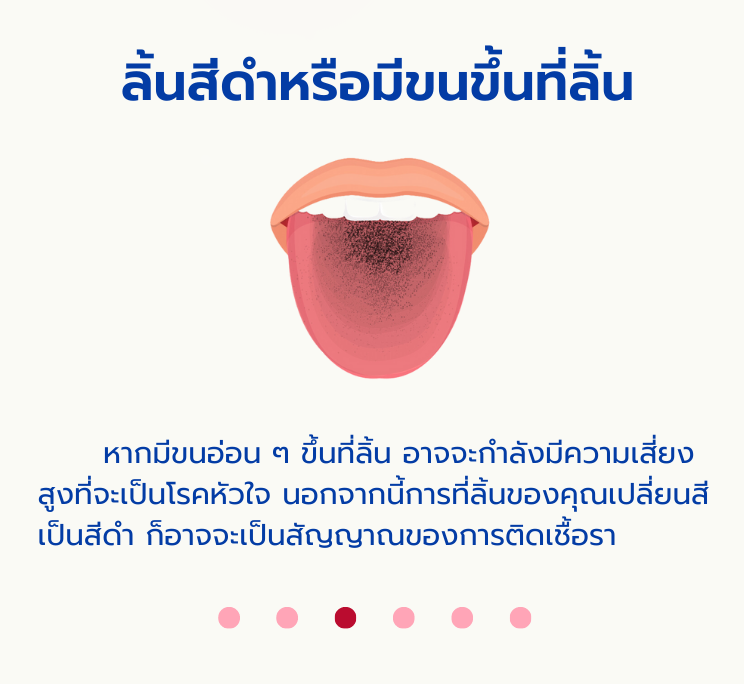 ลิ้นน2.png