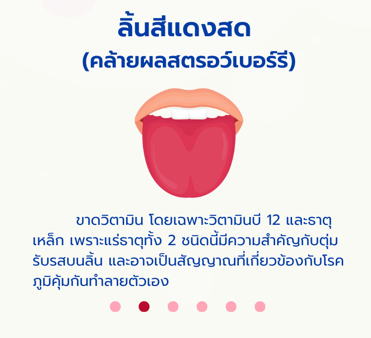 ลิ้นน1.png