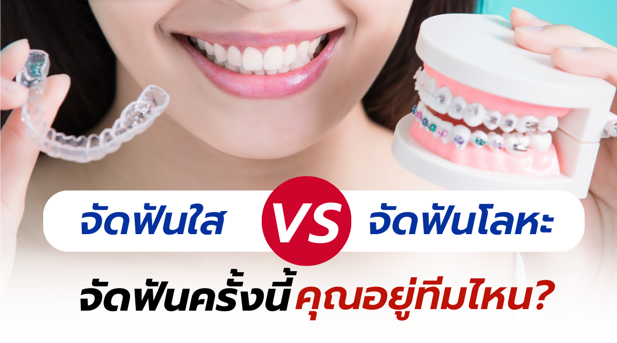 ร่าร.png