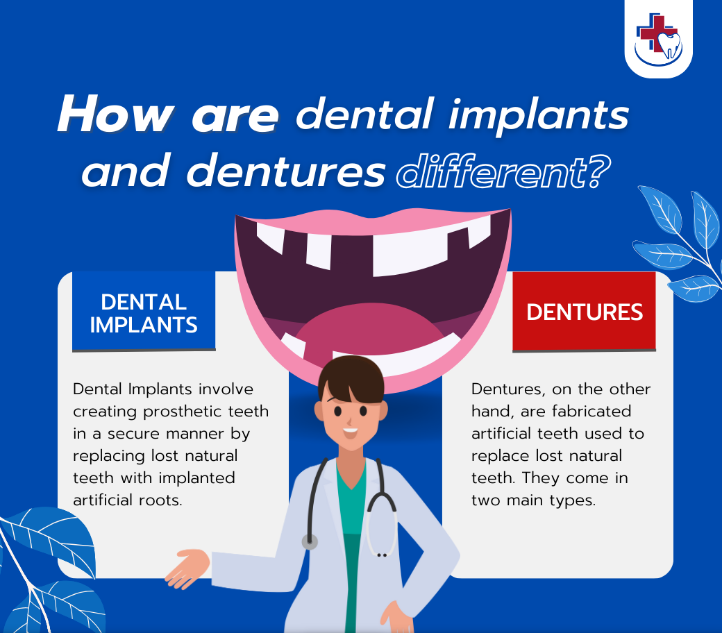 How are dental implants and dentures different? | Chiangmai Hospital ...