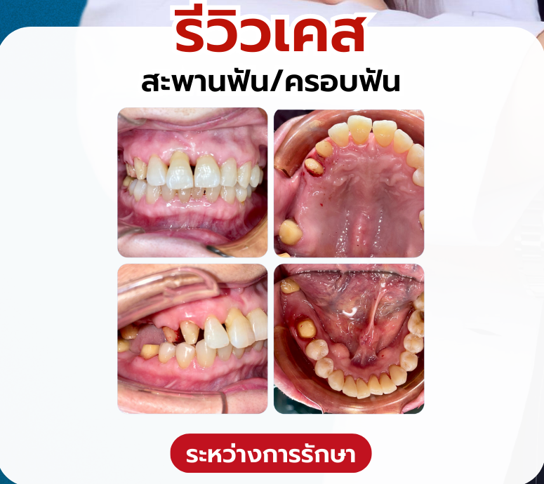 รากฟฟฟ.png