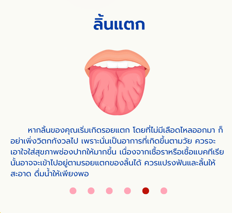 ลิ้นน4.png